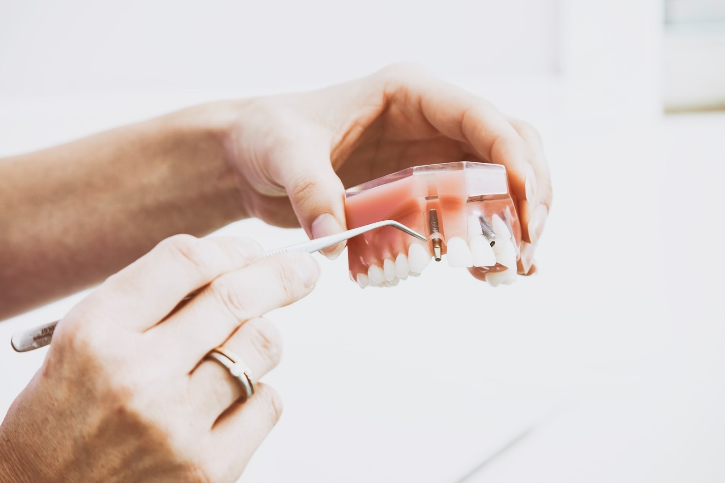 Clareamento dental: realce a beleza natural dos seus dentes